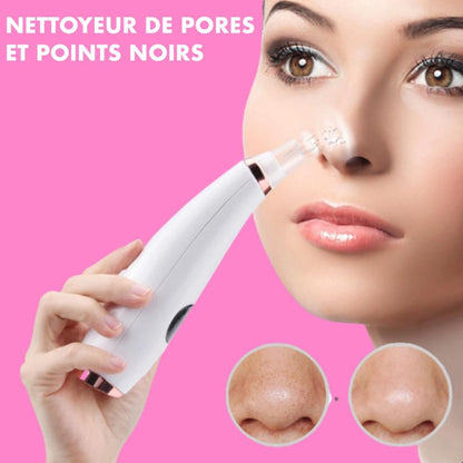 Black Head Remover