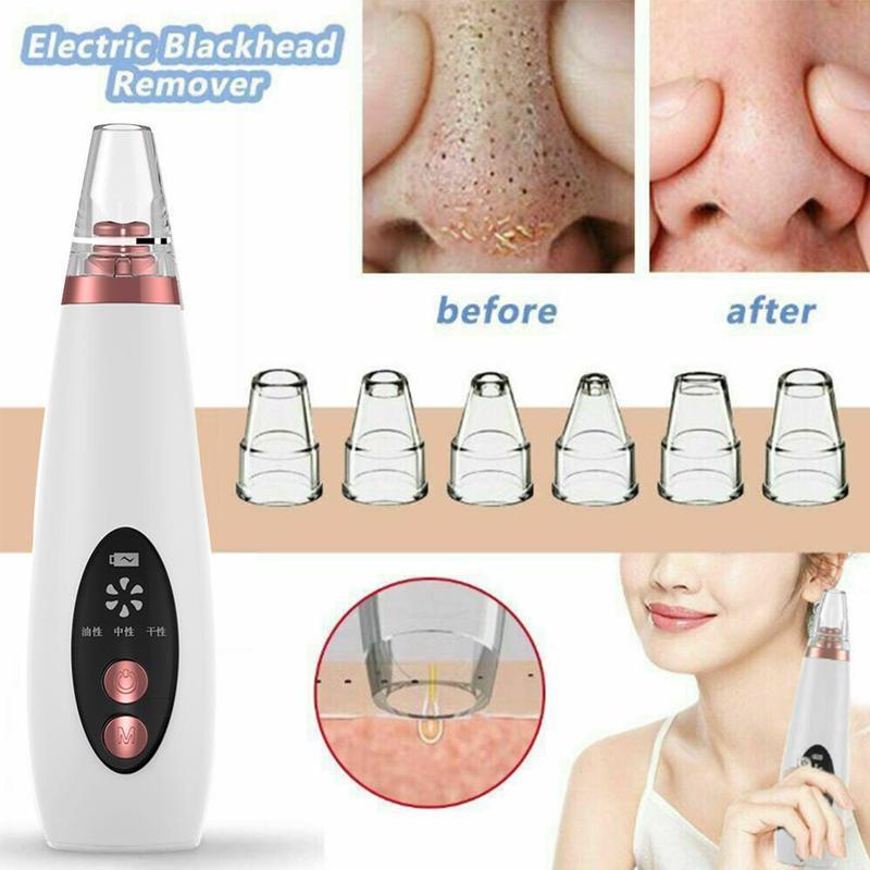 Black Head Remover